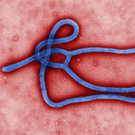 First Ebola case confirmed in the US