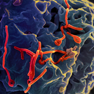 Ebola study reveals long-term health effects