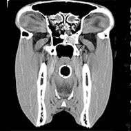 Imaging advances 'leading to better diagnoses'